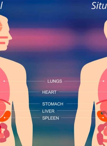 situs inversus u órganos invertidos