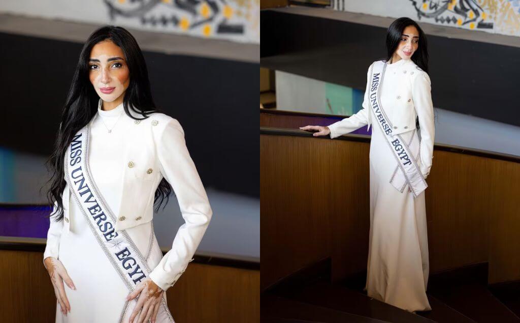 Logina Salah, la primer participante con Vitiligo en Miss Universo