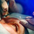 transplante de cornea