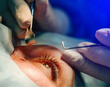 transplante de cornea