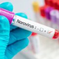 Prueba por Noravirus