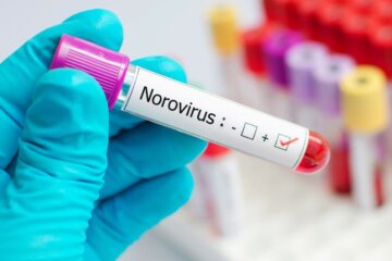 Prueba por Noravirus