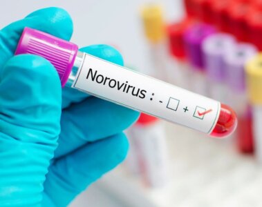 Prueba por Noravirus