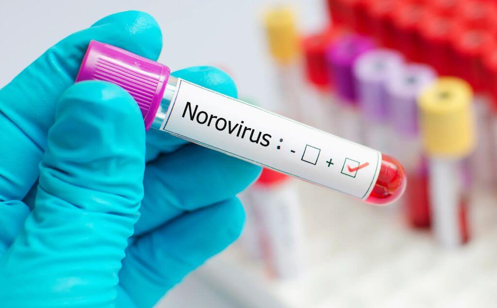 Prueba por Noravirus